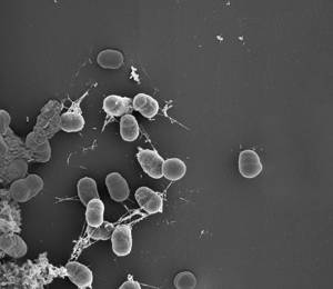 2025 SV The BIOSINK Project