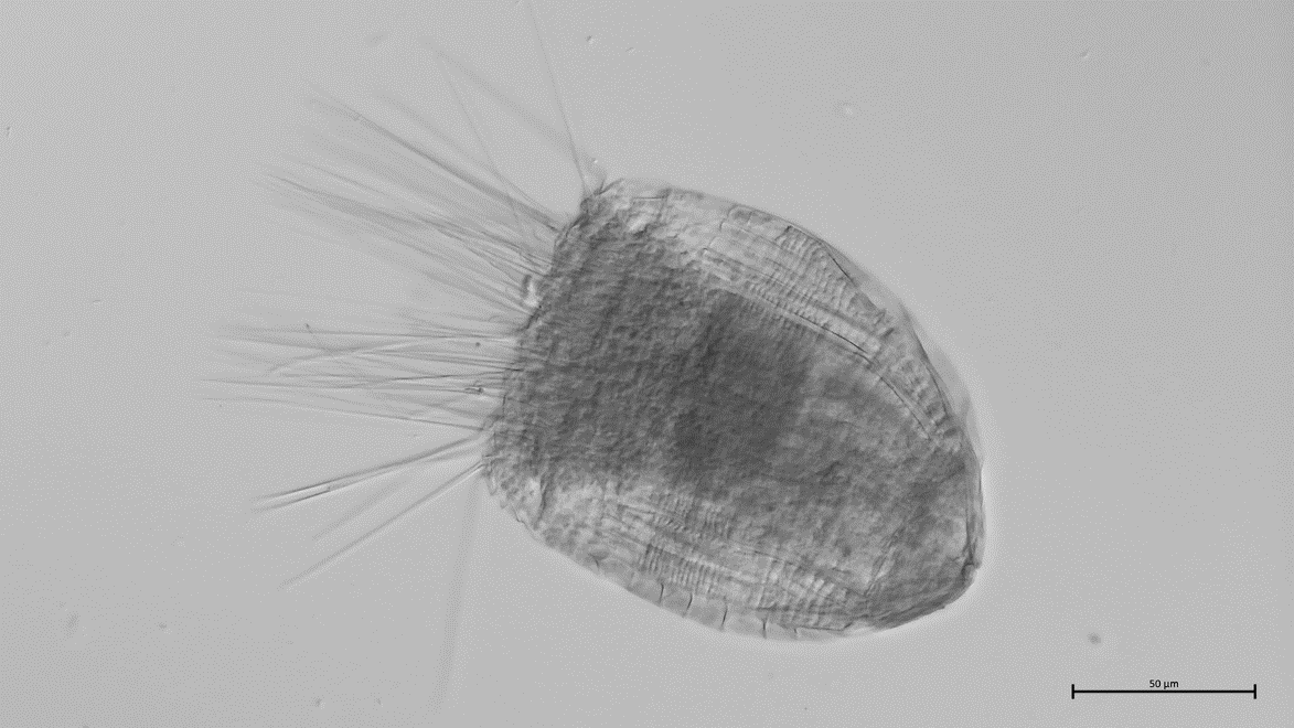 Rugiloricus sp., a loriciferan from the Barents Sea.